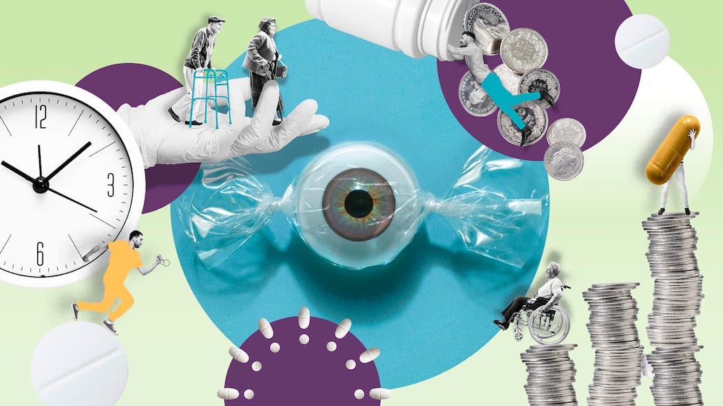 Viele Augenärzte fordern überrissene Preise für Katarakt-OP Illustration Grauer Star, Katarakt, Lasermethode, Augenarzt, Kritik in der SchweizGrauer Star Katarakt Beobachter-Prämienticker