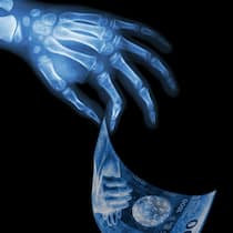 Datenleak enthüllt die Luxuslöhne in der Radiologie Röntgenbild-Hand greift nach 1000er-Note - Nach einem Cyberangriff offenbaren geleakte Gehaltslisten, wie stark die Spitzenlöhne radiologischer Fachärzte die Prämienzahlenden belasten