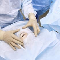 Augenärzte treiben Kosten mit Termin-Splitting hoch Ophthalmologist examining patient s eye in operating room model released, Symbolfoto property released, SANF00087