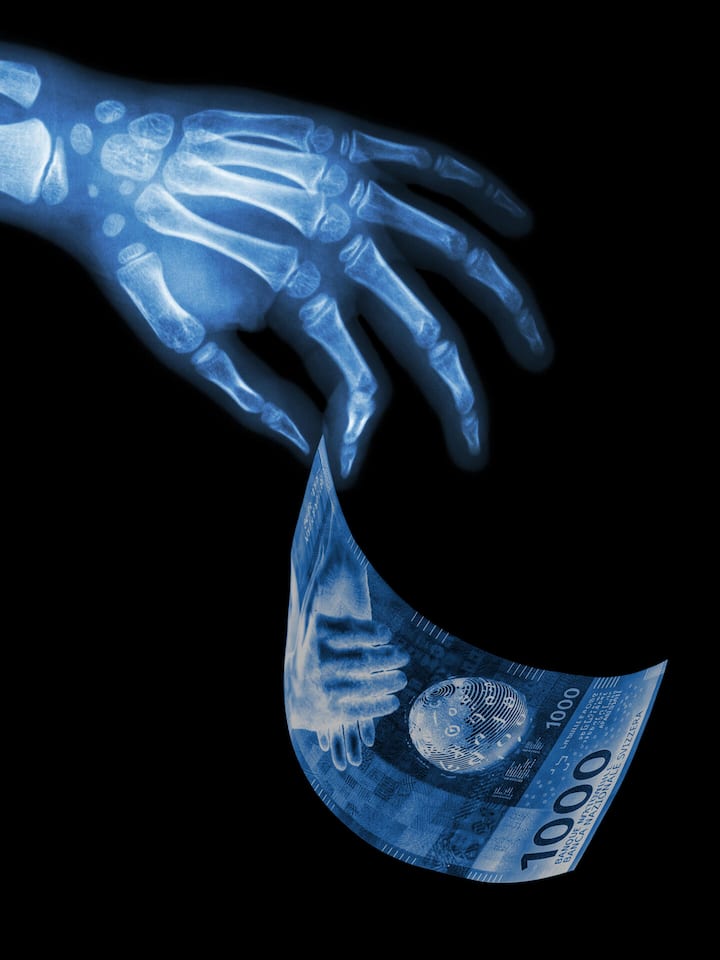 Datenleak enthüllt die Luxuslöhne in der Radiologie Röntgenbild-Hand greift nach 1000er-Note - Nach einem Cyberangriff offenbaren geleakte Gehaltslisten, wie stark die Spitzenlöhne radiologischer Fachärzte die Prämienzahlenden belasten